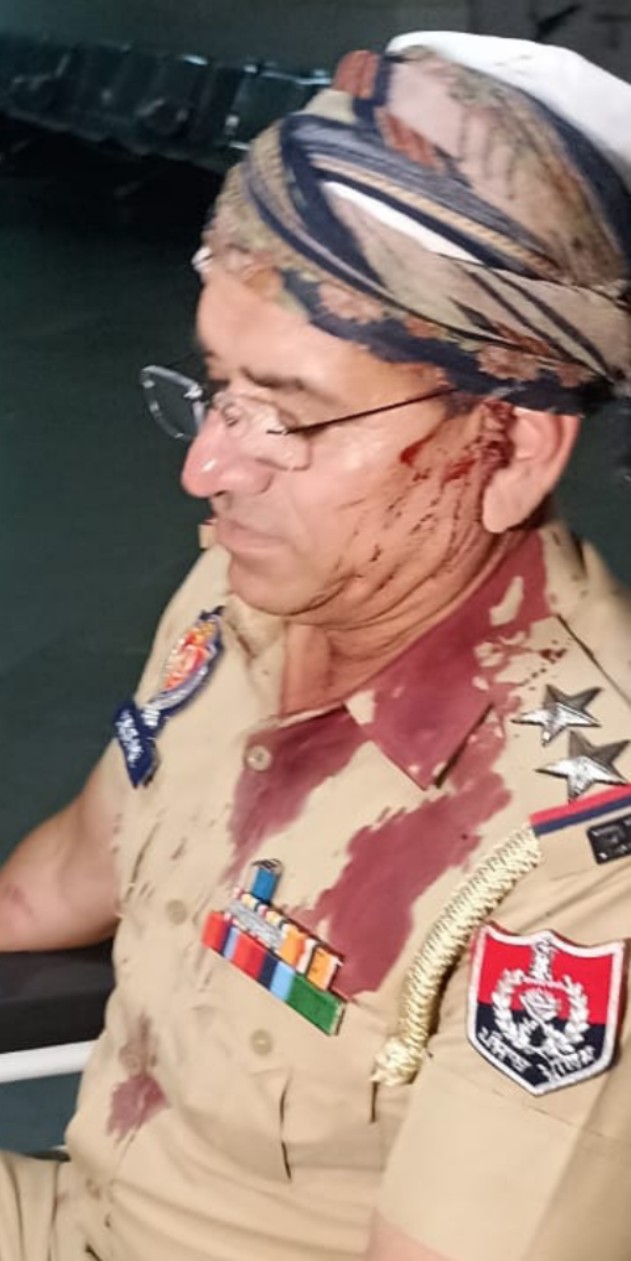 Shot fired in Khudda village, one injured, SHO's head split open in Karim Nagar Chichadwala